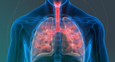 Science 37 Enables a Decentralized Model in Respiratory Trial with Pulmonary Function Testing